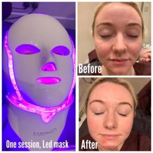 LED MASK, ANTI AGEING TREATMENTS, SKIN CLINIC AT URBAN SPA IN BISHOPS STORTFORD, HERTS AND ESSEX