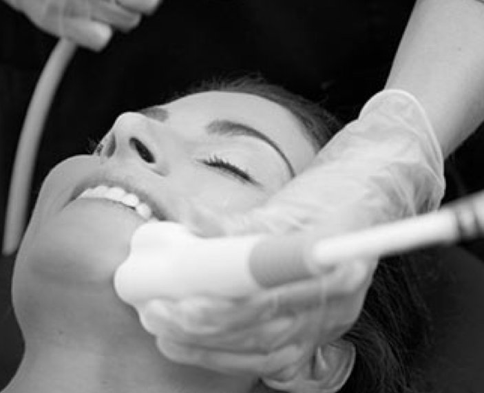 Venus Versa Tribella Facial Treatments That Work Top Skin Clinic Hertfordshire