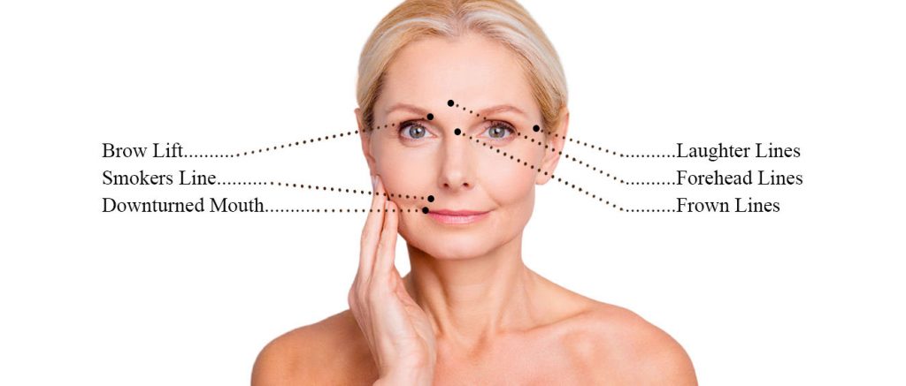 anti wrinkle injections, botox at The Skin Clinic at Urban Spa in Hertfordshire