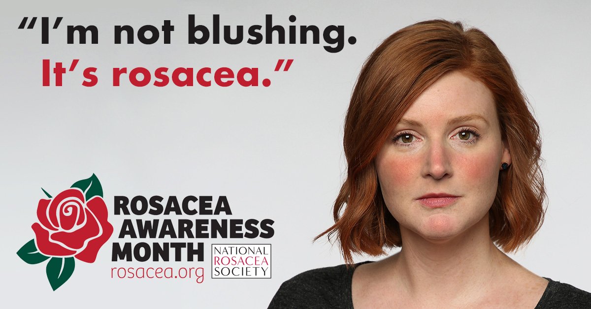 ROSACEA AWARENESS MONTH AT URBAN SPA SKIN CLINIC IN HERTFORDSHIRE