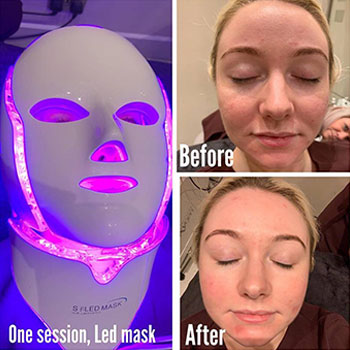 led light therapy at best skin clinic in hertfordshire led light therapy at best skin clinic in hertfordshire