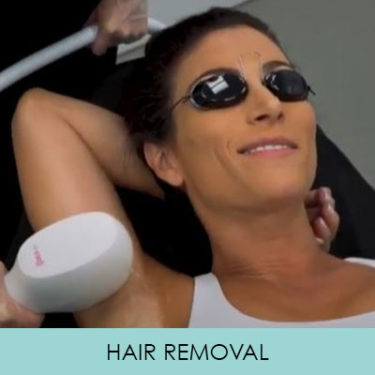 Venus Versa IPL Hair Removal