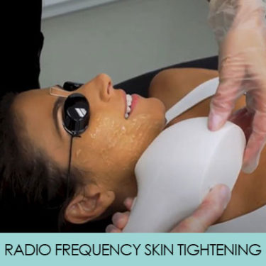  RADIO FREQUENCY SKIN TIGHTENING