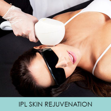 IPL IPL SKIN REJUVENATION
