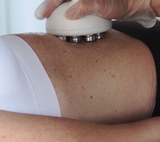 WEIGHT LOSS TREATMENTS IN HERTFORDSHIRE - VENUS VERSA