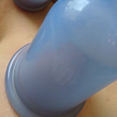 cupping at best beauty salon in bishops stortford