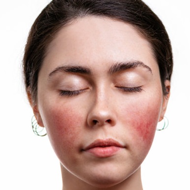 dermalogica facials at the skin clinic at urban spa in bishops stortford dermalogica facials at the skin clinic at urban spa in bishops stortford