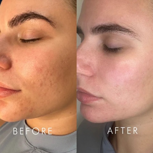 crystal clear before and after in Bishops Stortford Hertfordshire