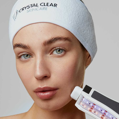 crystal clear resurface and heal microdermabrasion, Hertfordshire clinic