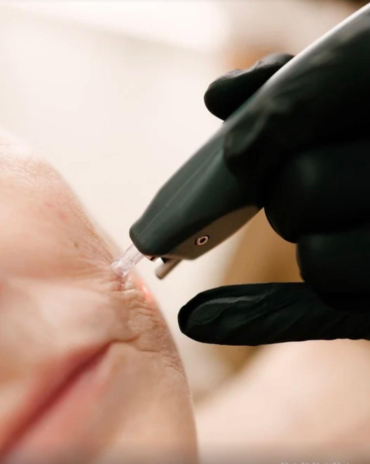 superboost facials at urban spa skin clinic in bishops stortford, hertfordshire