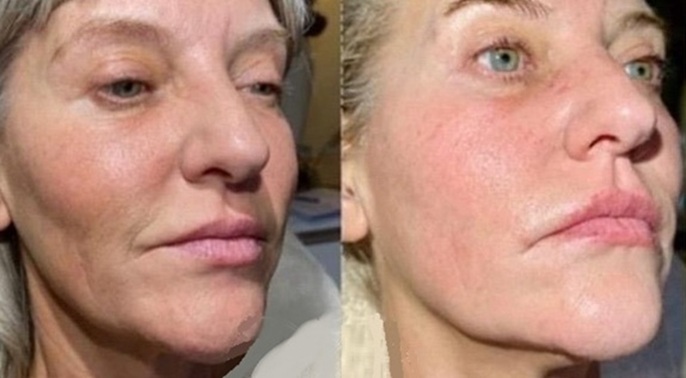 SUPERBOOST FACIALS AT SKIN CLINIC URBAN SPA IN BISHOPS STORTFORD SUPERBOOST FACIALS AT SKIN CLINIC URBAN SPA IN BISHOPS STORTFORD