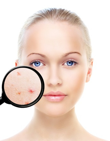 Retinol Treatments, SkinCeuticals Facials, Top Skin Clinic & Beauty  Spa, Bishop's Stortford